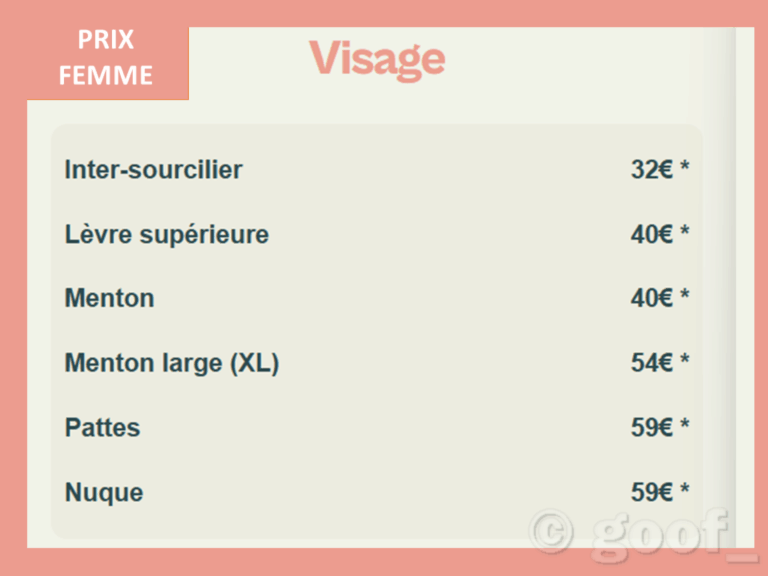 prix epilation laser femme bordeaux