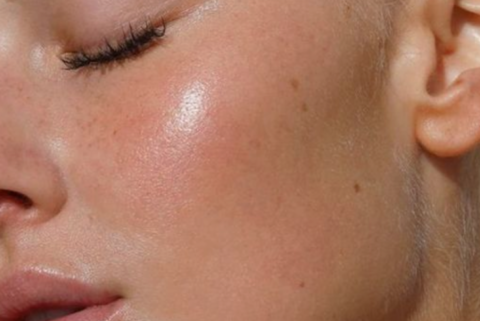 epilation laser visage Bordeaux GOOF